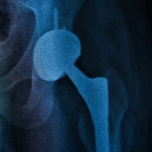 tek asamali ameliyatla sagligina kavustu pNmWcRDD