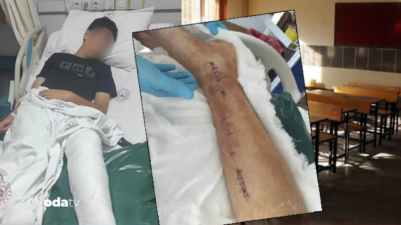 ozel okulda akran dehseti posetli iskence yonetimin savunmasi pes dedirtti UHe5Wh8q